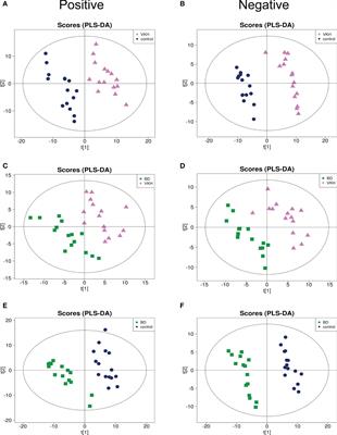 Metabolomic Analysis of Aqueous Humor Identifies Aberrant Amino Acid and Fatty Acid Metabolism in Vogt-Koyanagi-Harada and Behcet’s Disease